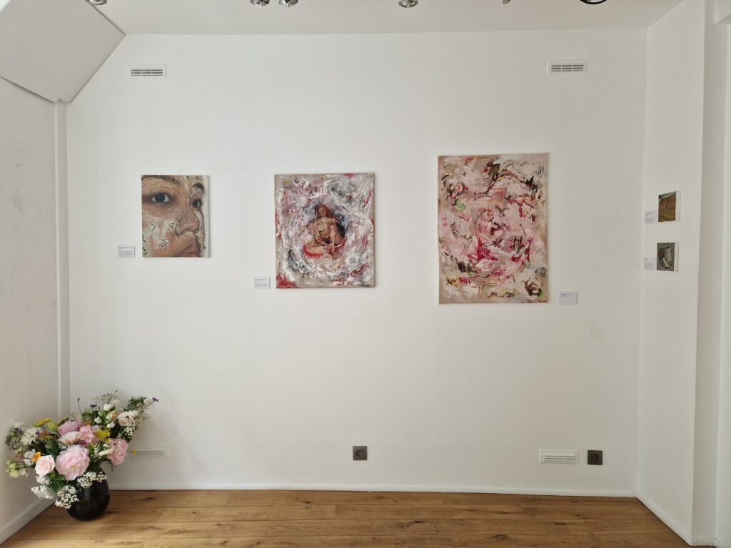 Intimacy Issues - vue d'exposition